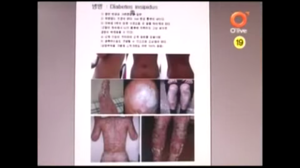 불치병에 걸린 남자친구.jpg | 인스티즈