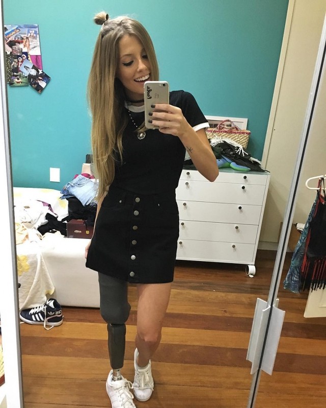 다리 한 쪽이 없지만 유쾌한 그녀 | 인스티즈