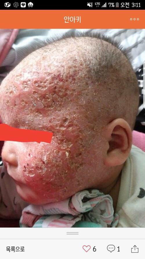 혐주의/ 안아키가 뭔지 아직 모르는 사람들 다 들어와봐.. 이거 생각보다 심각한 사회문제임 | 인스티즈