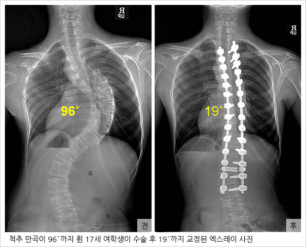 현대인이 많이 앓고 있는 질병중의 하나 | 인스티즈