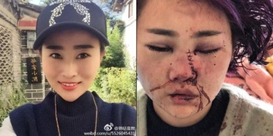중국서 여성 관광객 무차별 폭행.. 사건 은폐한 경찰에 공분 | 인스티즈