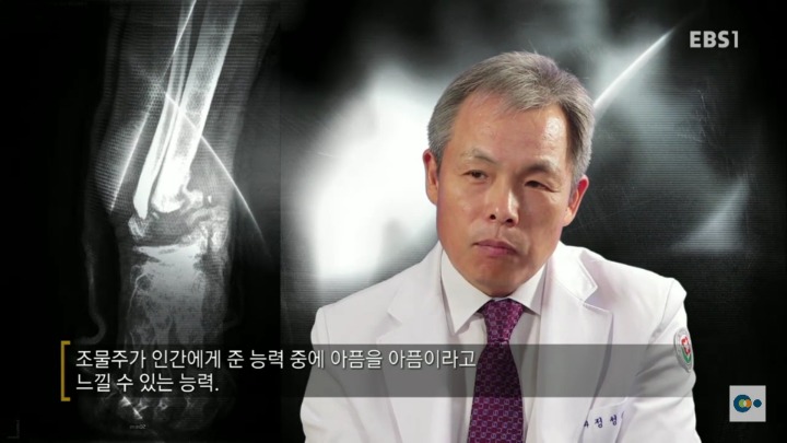 아픔을 느낄 수 없다면 좋은걸까? 무통증 환자 삼남매 이야기. #2 | 인스티즈