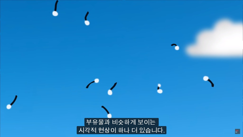 여러분의 눈에 둥둥 떠다니는 그것들은 무엇일까요? | 인스티즈