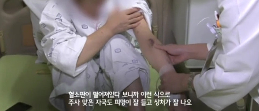 10년 동안 매일 소주 3~4병을 마신 34살 여성의 몸 상태 | 인스티즈